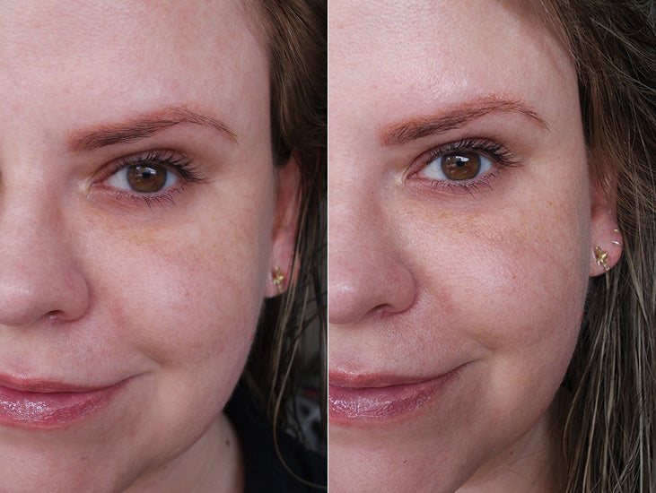 ✨ “El Secreto de la Piel Perfecta: Sérum 24K con Ácido Hialurónico”